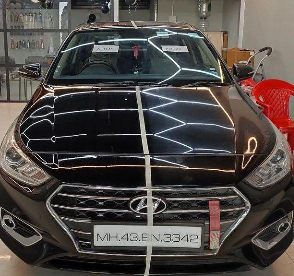 Hyundai Verna 1.6 CRDI SX (O) 2019